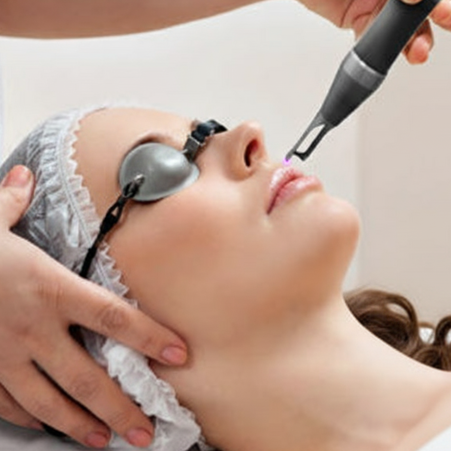 Tratamiento con láser de picosegundos